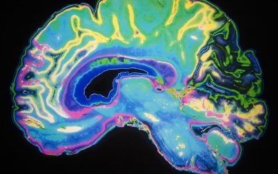 Mobile stroke units deliver faster care to improve outcomes, lessen chance for disability