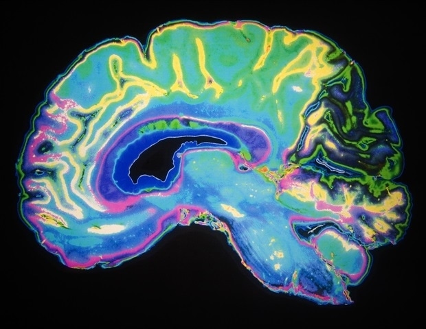 Mobile stroke units deliver faster care to improve outcomes, lessen chance for disability